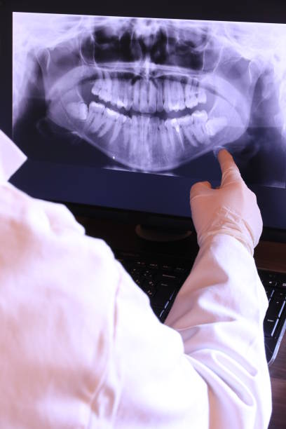 Best Emergency Dental Care for Trauma or Injury in Boronda, CA