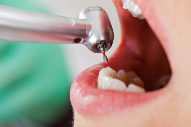 Best Weekend Emergency Dentist in Boronda, CA